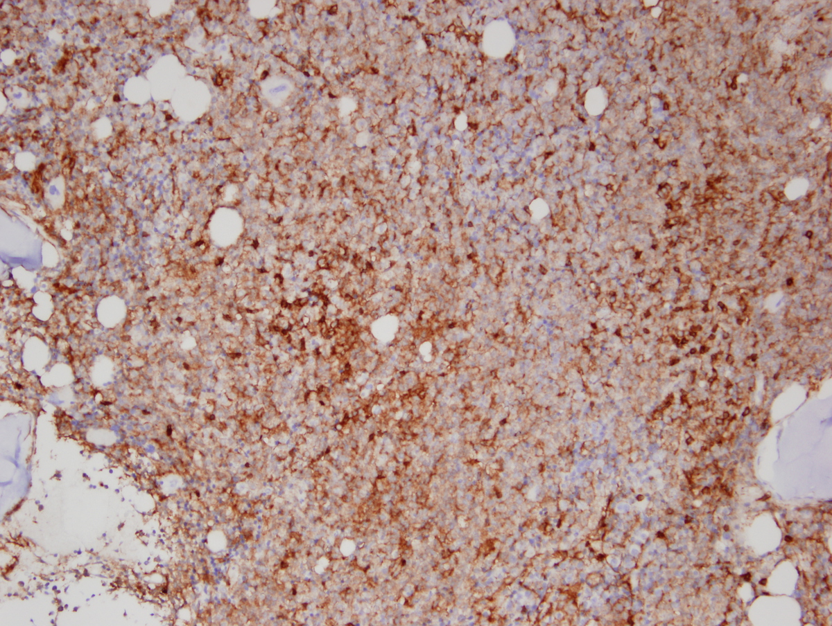 CD4